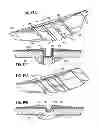 Fig. 06 - Drywall finishing system