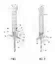 Fig. 02 - Holder for concrete anchors