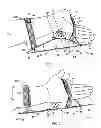 Fig. 02 - SURGICAL POSITIONING AID