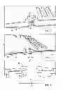 Fig. 06 - SURGICAL POSITIONING AID