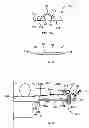 Fig. 11 - SURGICAL POSITIONING AID