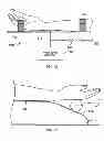 Fig. 13 - SURGICAL POSITIONING AID