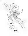 Fig. 04 - Suspension and body attachment system and differential pressure suit for body weight support devices