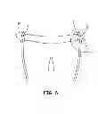 Fig. 07 - Suspension and body attachment system and differential pressure suit for body weight support devices