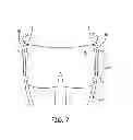 Fig. 08 - Suspension and body attachment system and differential pressure suit for body weight support devices