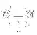 Fig. 09 - Suspension and body attachment system and differential pressure suit for body weight support devices