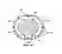 Fig. 49 - Suspension and body attachment system and differential pressure suit for body weight support devices