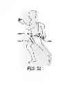Fig. 53 - Suspension and body attachment system and differential pressure suit for body weight support devices