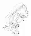 Fig. 09 - Filter for a pneumatic tire