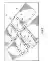Fig. 06 - Pill container carrier
