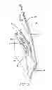 Fig. 08 - Aircraft airbag system