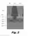 Fig. 03 - Memristor cell structures for high density arrays