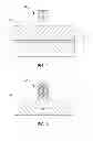 Fig. 02 - MOSFET gate and source/drain contact metallization