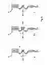 Fig. 04 - Air spring having hybrid bellows