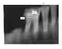 Fig. 01 - Dental-based identification system
