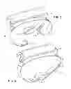 Fig. 02 - Portable ski and ski pole carrier system