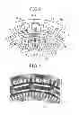 Fig. 06 - Double-stator motor