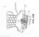 Fig. 178 - Accessories for use with housing for an electronic device