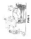 Fig. 02 - Panic device with local alarm and distal signaling capability