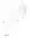 Fig. 03 - PERIMETER BREACH ALARM SYSTEMS