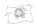 Fig. 01 - Electronic device with input-output component mounting structures