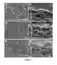 Fig. 16 - Electrochemically activated C-MEMS electrodes for on-chip micro-supercapacitors