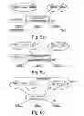 Fig. 09 - Concept for load balancing in a radio access network
