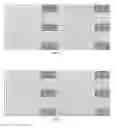 Fig. 04 - Control channel transmission method and apparatus to implement transmission of ePDCCHs through an eREG in a unit physical resource block