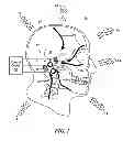 Fig. 02 - Hearing protection system
