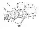 Fig. 02 - Fiber optic cables with access features