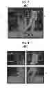 Fig. 04 - Techniques to provide an enhanced video replay