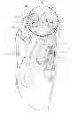 Fig. 01 - Sealing device including a first replaceable compliant sealing member and a latch member