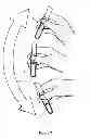 Fig. 07 - Assembly of container/applicator for a mascara composition