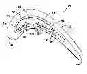 Fig. 01 - Turbine bucket with squealer tip