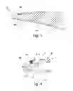 Fig. 04 - Compressor blade of a gas turbine as well as method for manufacturing said blade