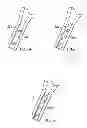Fig. 04 - Direct drive rotation device for passively moving fluid