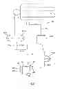 Fig. 12 - Oxygenator and extracorporeal circuit