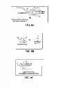 Fig. 09 - FIBER-OPTIC BIOSENSOR AND BIOSENSING METHODS