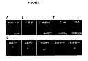 Fig. 04 - Functional Targeted Brain Endoskeletonization
