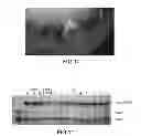 Fig. 07 - Peptides capable of forming a convalent complex, and uses thereof