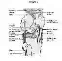 Fig. 02 - DISRUPTED CARTILAGE PRODUCTS