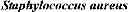 Fig. 02 - Acetyl-CoA producing enzymes in yeast