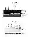 Fig. 02 - Peptide aptamers against tenascin C
