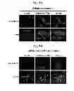 Fig. 08 - Peptide aptamers against tenascin C