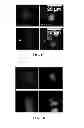 Fig. 04 - Image analysis and measurement of biological samples