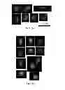 Fig. 09 - Image analysis and measurement of biological samples