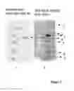 Fig. 08 - SOLUBLE HUMAN M-CSF RECEPTOR AND USES THEREOF