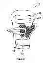Fig. 04 - AQUATIC RESISTANCE TRAINING EQUIPMENT