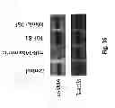 Fig. 35 - COMPOSITIONS AND METHODS FOR THE DIAGNOSIS AND TREATMENT OF INLAMMATORY DISORDERS AND FIBROTIC DISEASE