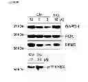 Fig. 05 - Methods of detecting therapeutic exosomes